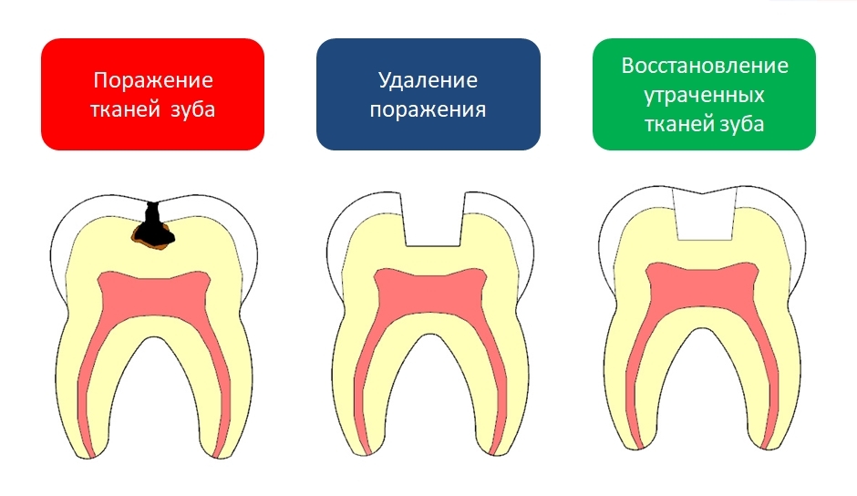 Ткани зуба