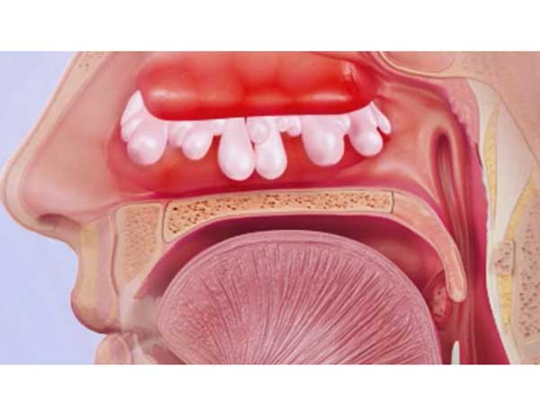 Как самарцы, особенно ЛОР-врачи, спасаются от поллиноза