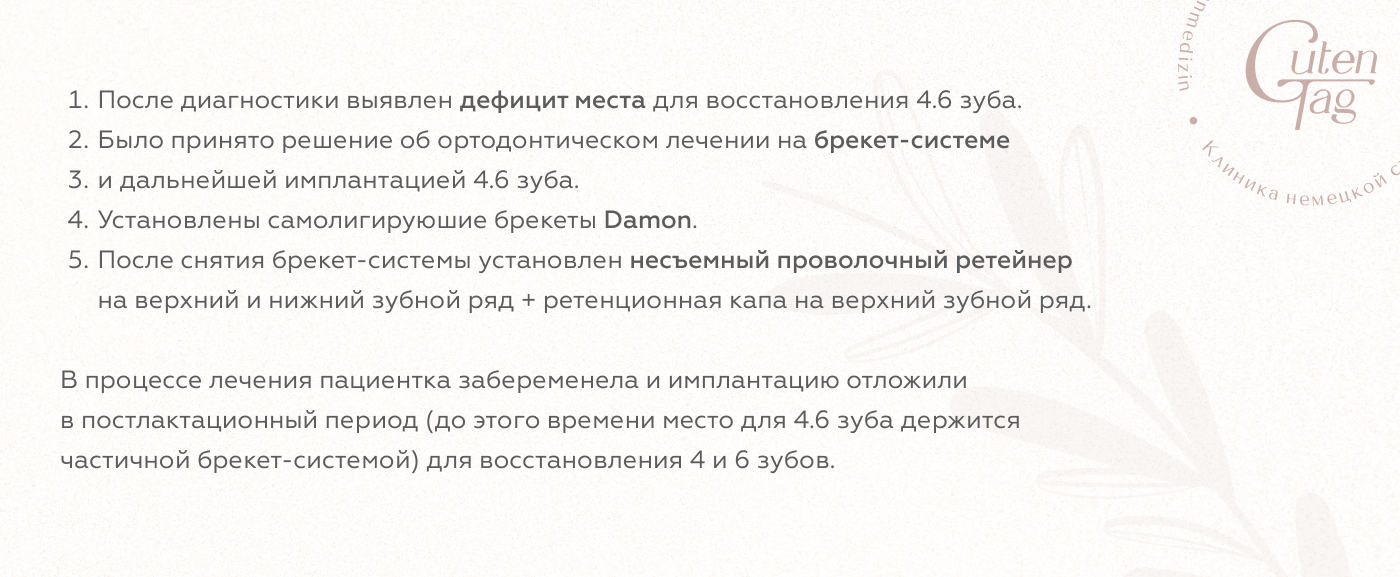 Исправление прикуса у взрослых в Перми | Клиника «ГутенТаг»