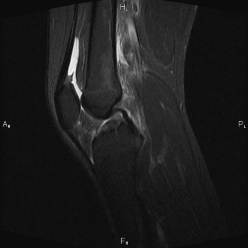 Мрт суставов подольск. Пкс коленного сустава мрт. Снимки мрт голеностопного сустава. Мрт суставов подольск. Мрт суставов подольск.