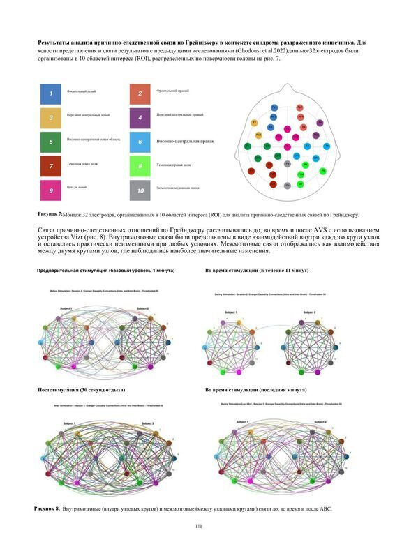 ЭЭГ-исследование NeuroVIZR 2024