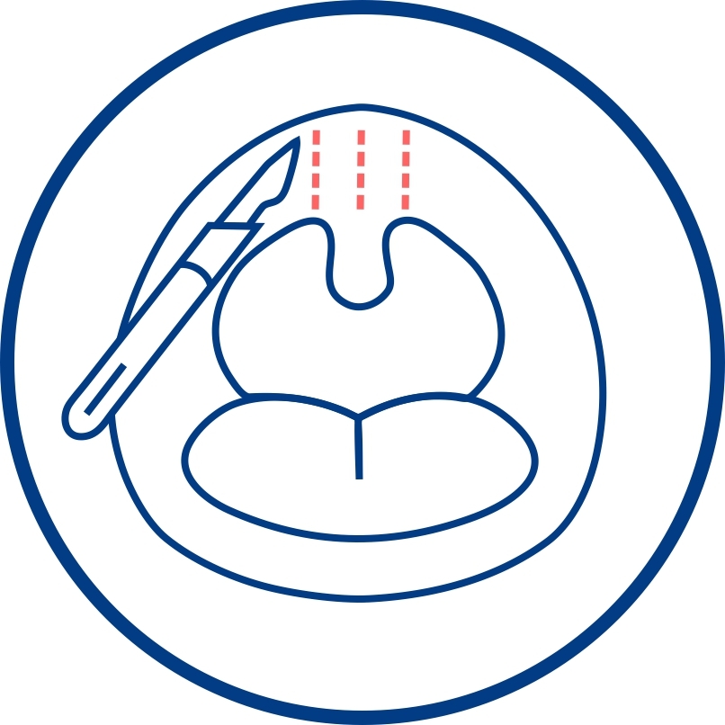 Bipap-терапия и что такое BiPAP-терапия? Его отличие от СИПАП-терапии