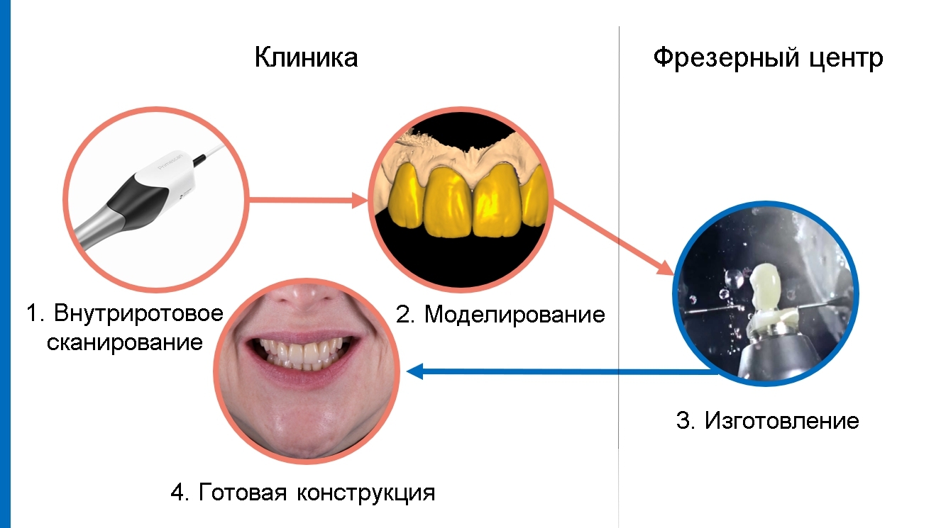 CAD/CAM технологии в стоматологии