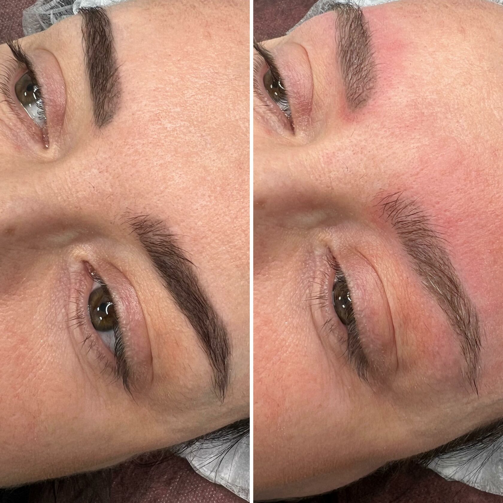 Услуга удаления перманентного макияжа в студии Ушаковой Ким