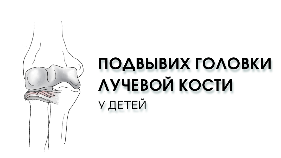 Рентген локтевого сустава - цена в Москве: сделать платную рентгенографию локтевого сустава