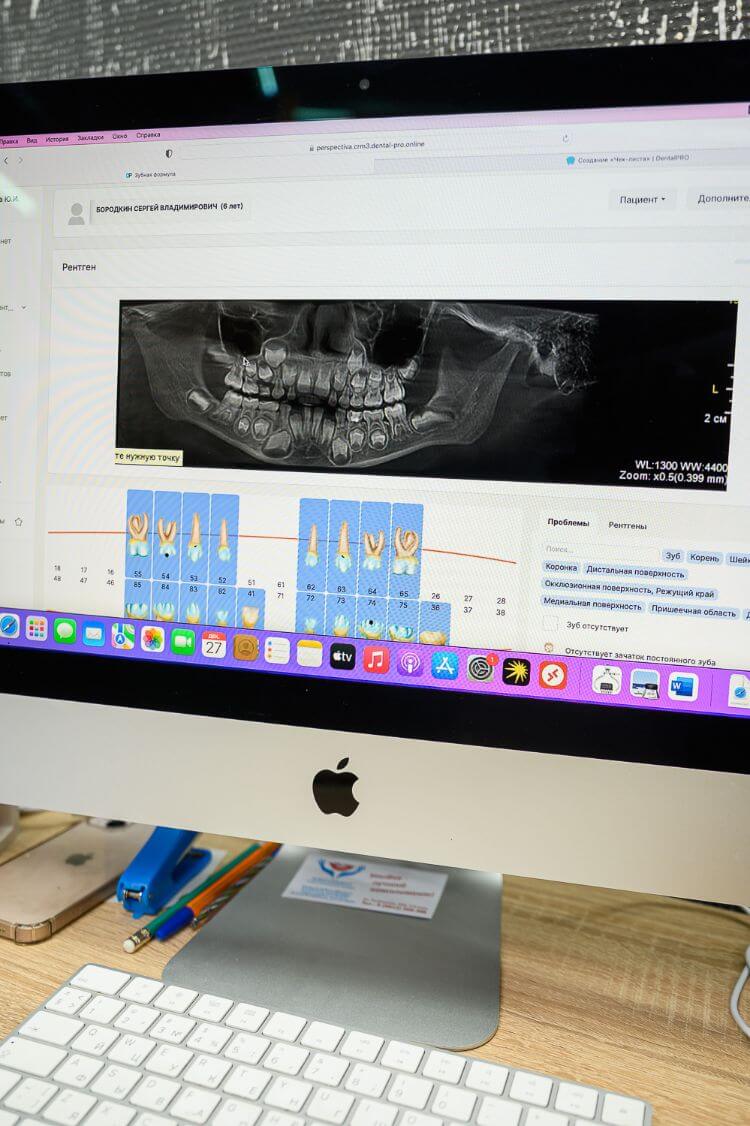цифровая диагностика циркониевых коронок стоматология Комплимент