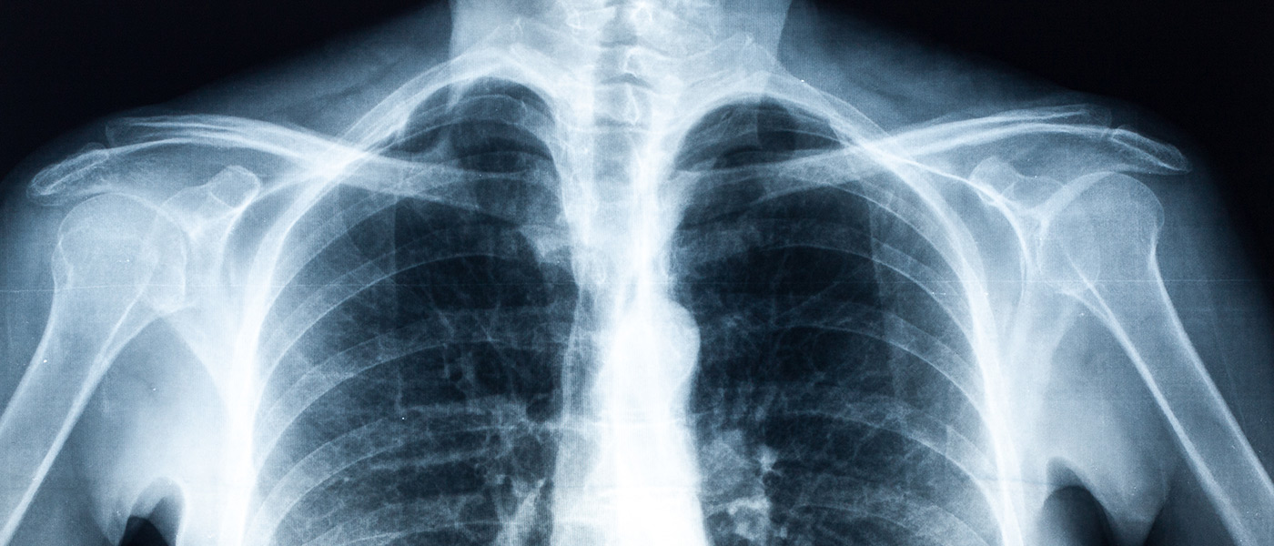 Снимок руки анны берты рентген. The first x ray. Доктор рентген позвоночника. Вильям крукс изобретения. Рентген снимок.