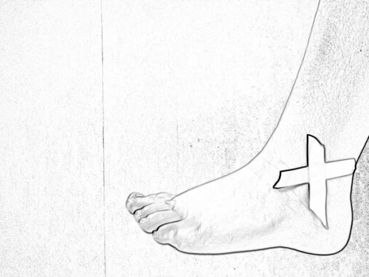 Отёк голеностопа. Как убрать?