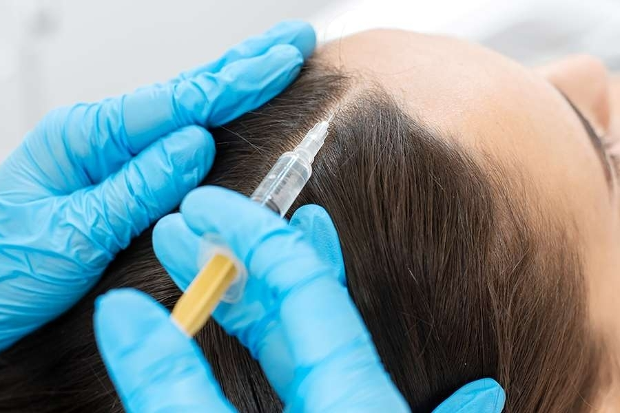 Мезотерапия волос