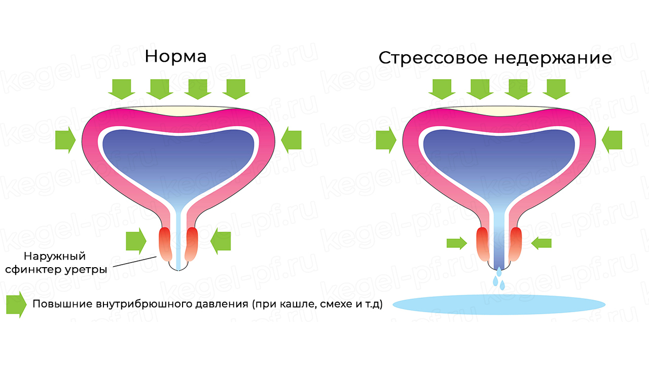 Упражнения Кегеля - Seni