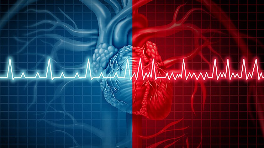 СОАС может спровоцировать ряд сердечно-сосудистых заболеваний, увеличивая нагрузку на сердце