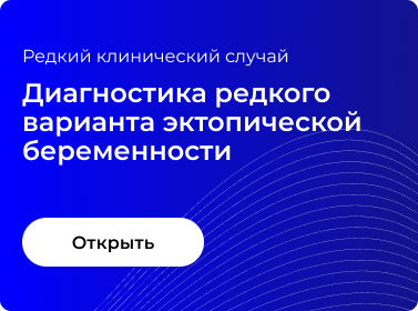 ДИАГНОСТИКА РЕДКОГО ВАРИАНТА ЭКТОПИЧЕСКОЙ БЕРЕМЕННОСТИ