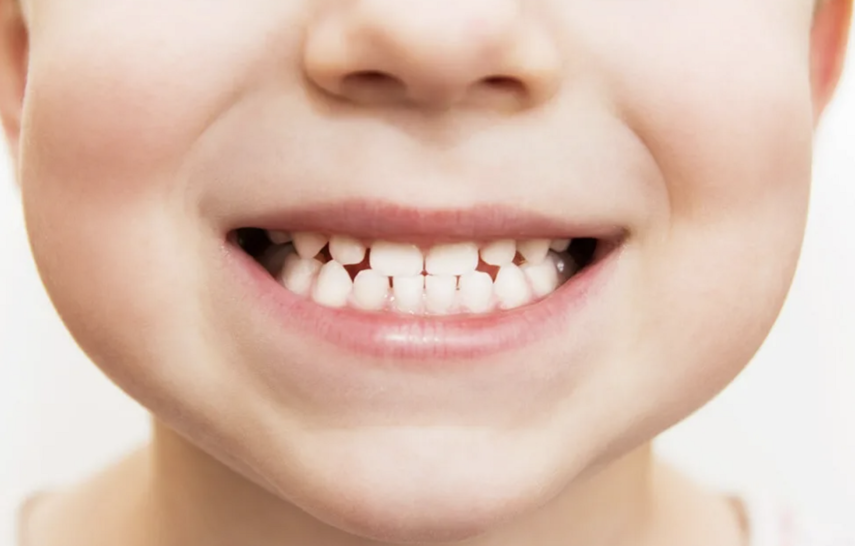 Неправильный прикус у ребенка