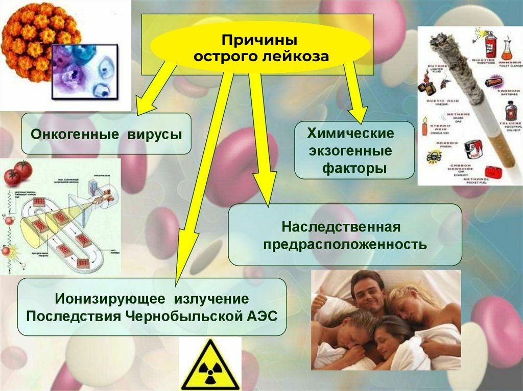 Лейкемия почему. Факторы риска развития лейкоза. Факторы риска острого лейкоза. Острый лейкоз причины возникновения. Причины развития лейкозов.