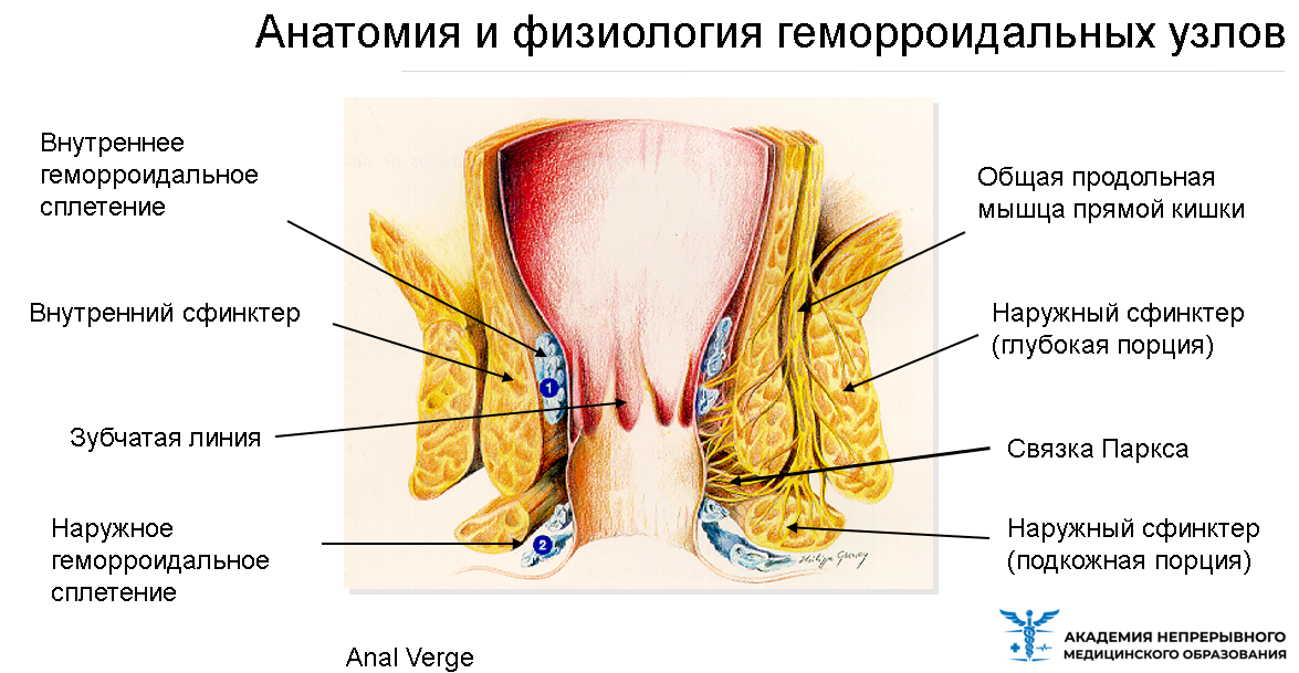 Внутренний геморрой: симптомы, признаки, диагностика и лечение внутреннего геморроя 1 и 2 степени