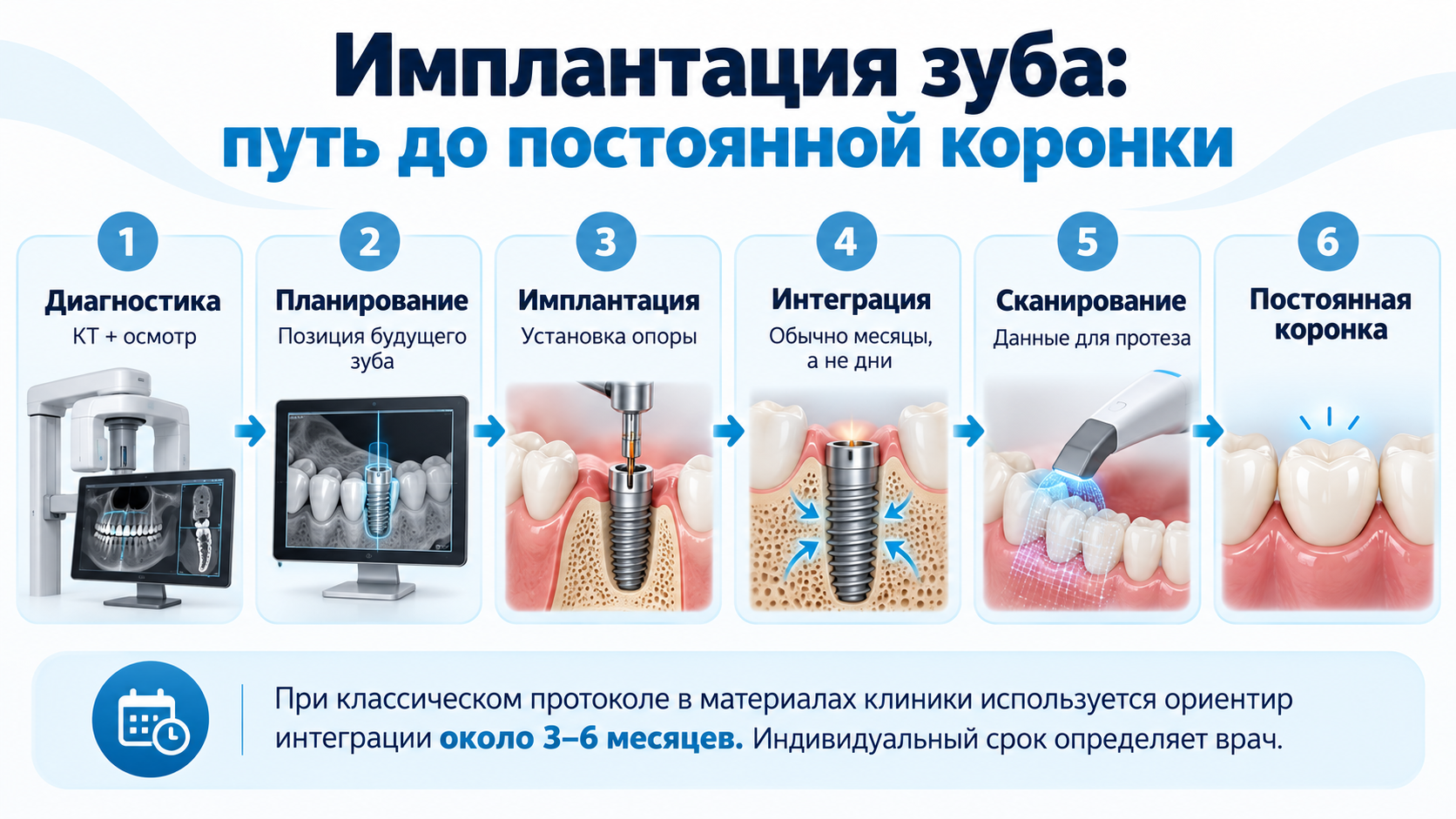Этапы имплантации зуба от КТ до постоянной коронки