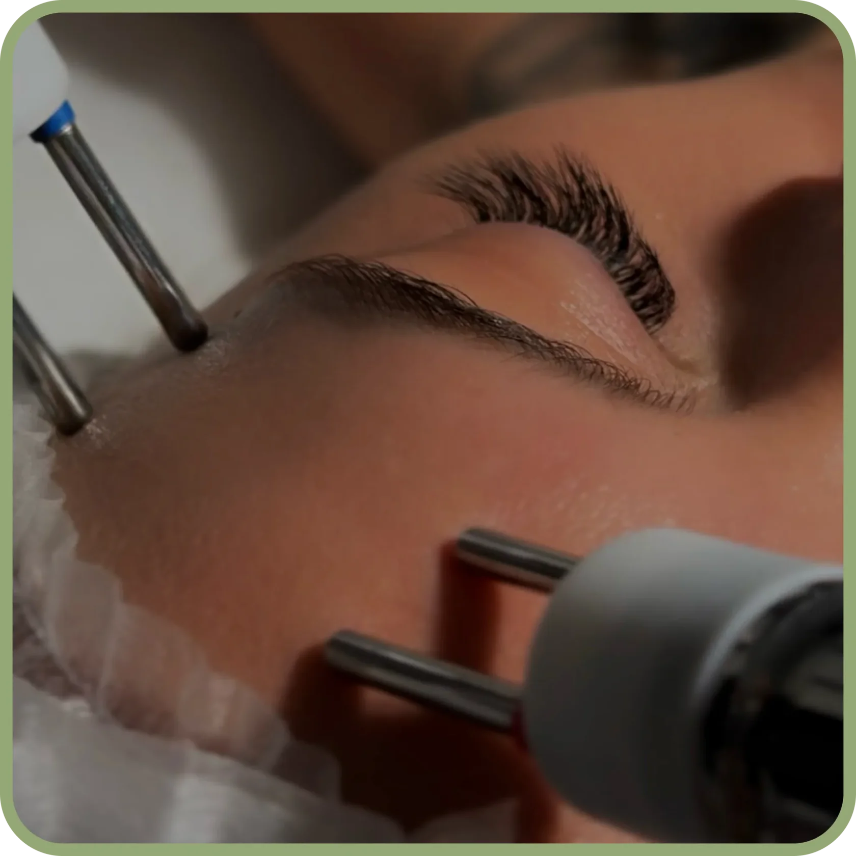 Фото микротоковой терапии в клинике косметологии Uniqderm