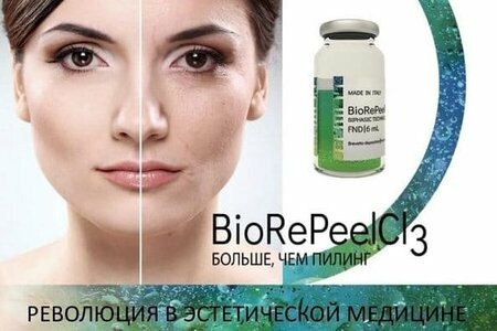 Химический пилинг