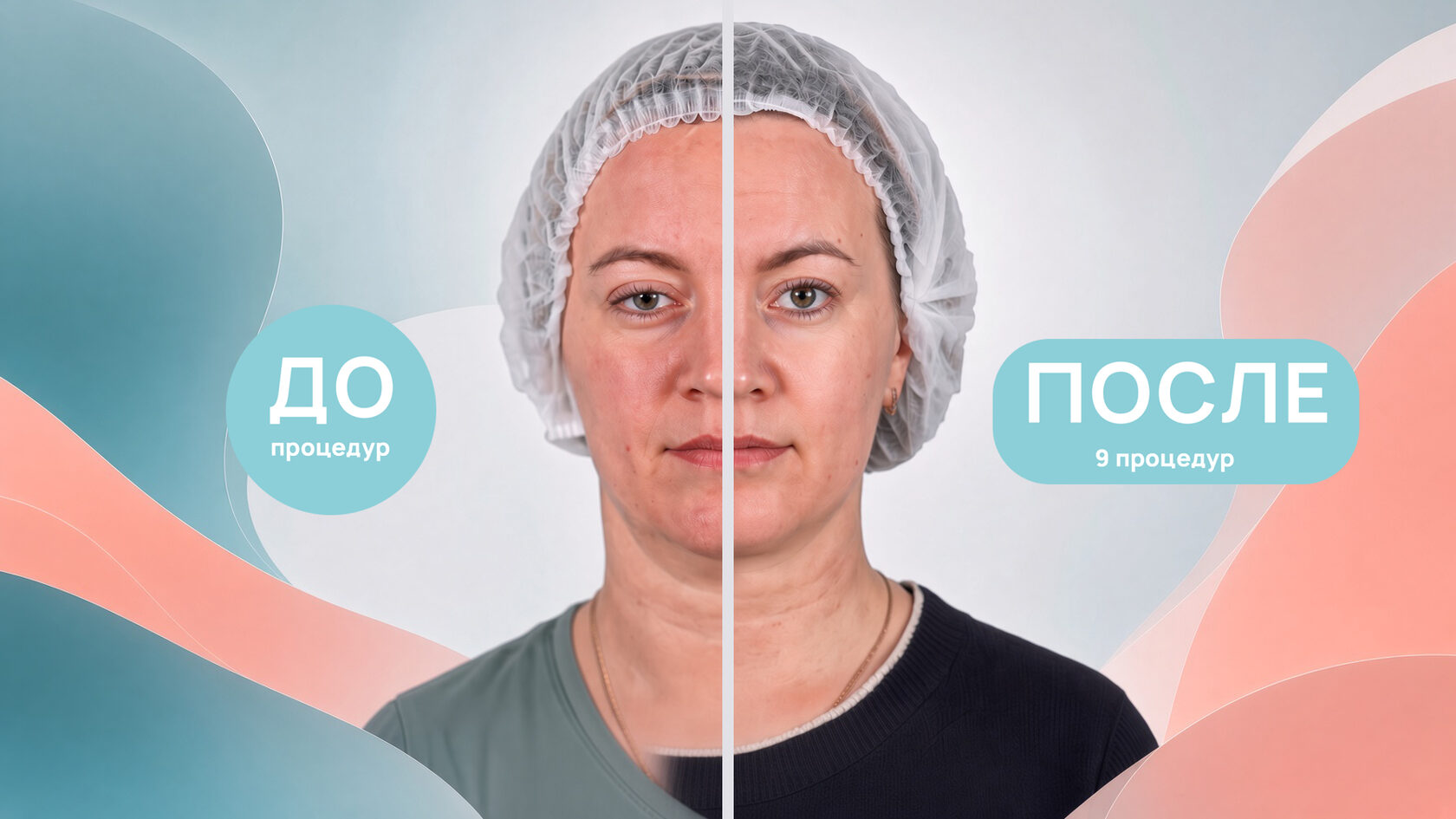 Процедура в косметологическом кабинете