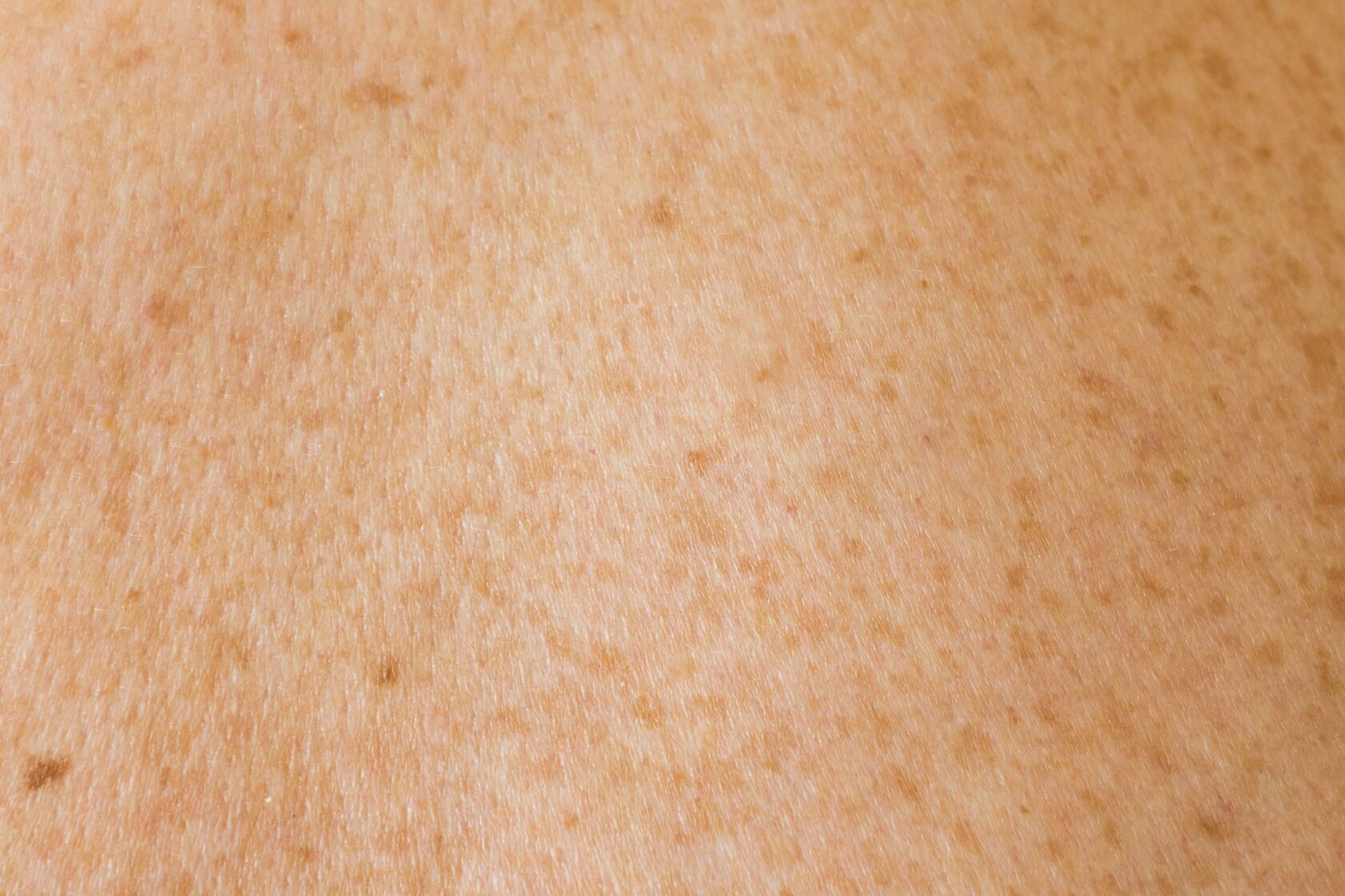 An extreme close-up of skin — texture, warmth, the body as topography.