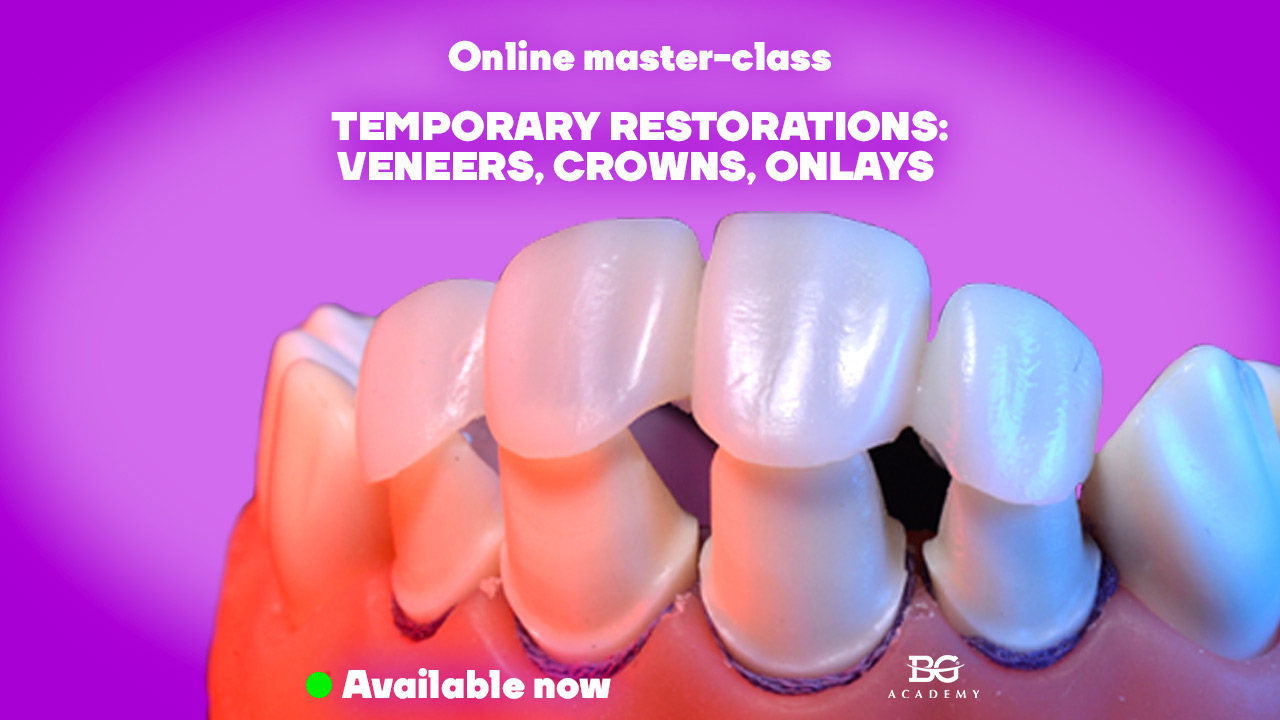 Temporary restorations veneers, crowns, onlays. Online masterclass