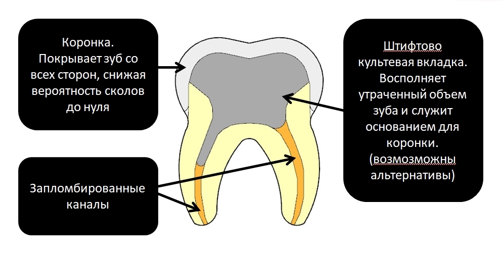 Удалить нервы запломбировать