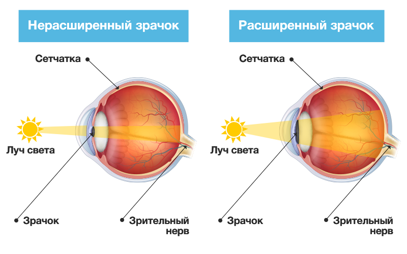 Глаукома схема глаза. Процесс сужения и расширения зрачка. Глаукома строение глаза. Сужение и расширение зрачка глаза.