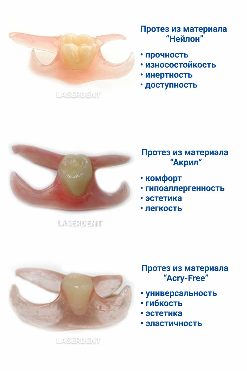 Зубные протезы «бабочка»