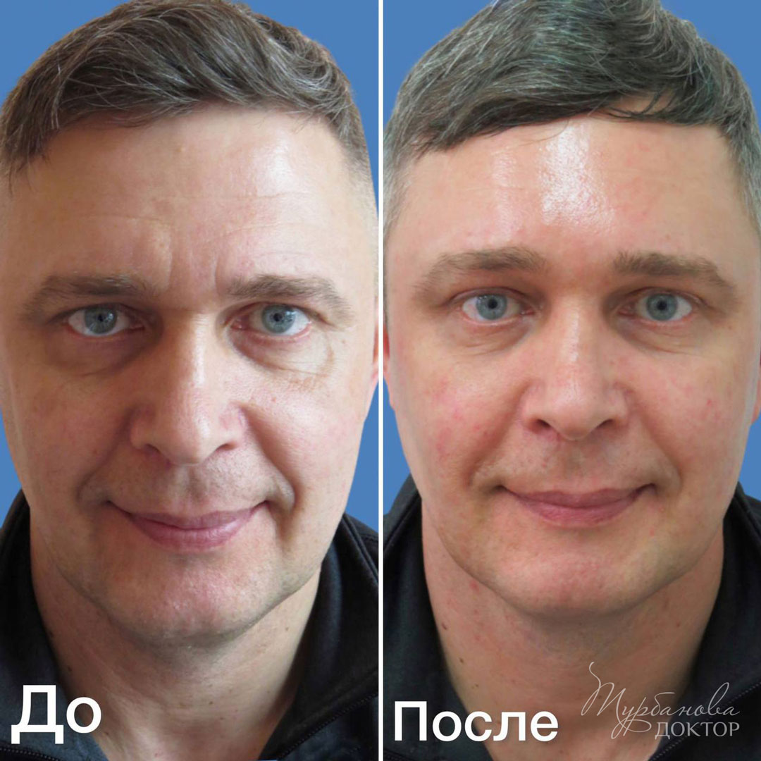 Dental-Revue Статьи Имплантология БьютиФикация: глобальный подход к красоте лица