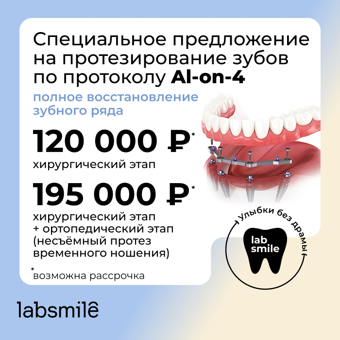 All-on-4 — протезирование на четырёх имплантах