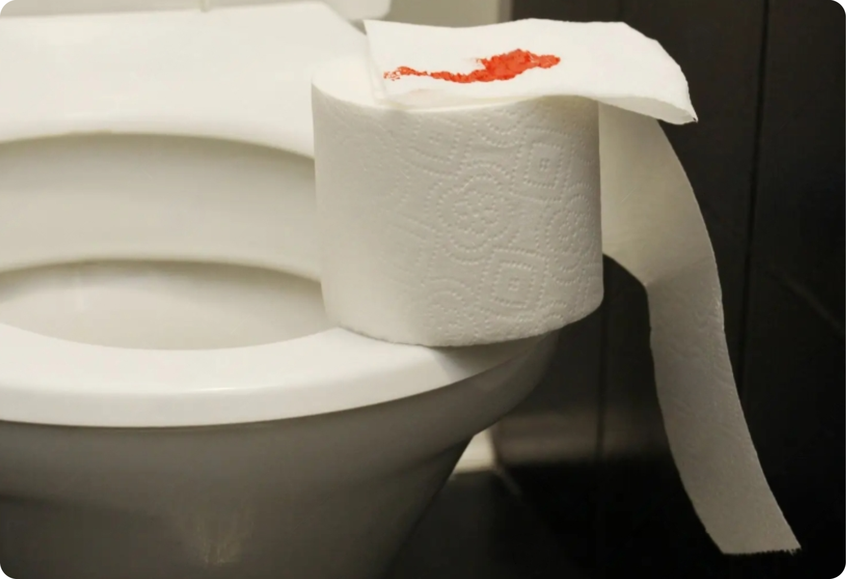 Кровь на туалетной бумаге. Кровяная туалетная бумага. Кровь на туалетной бумаге после стула. Алая кровь на туалетной бумаге.