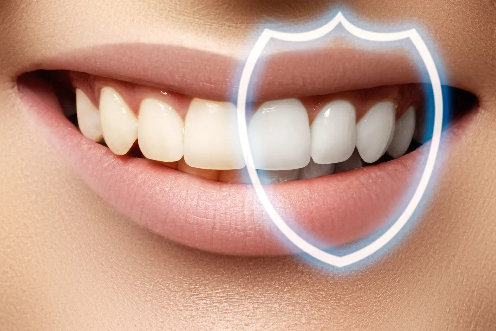 зубная эмаль и отбеливние зубов