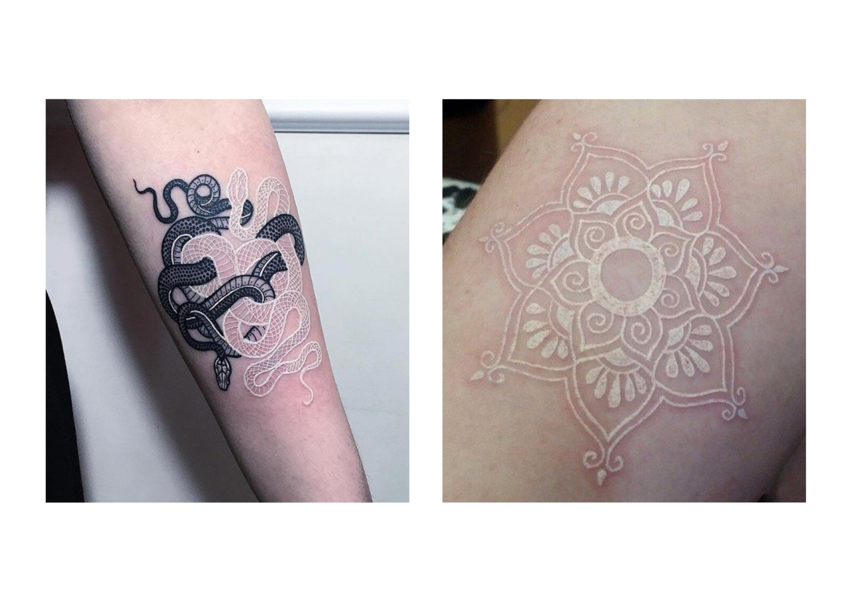 Белые татуировки: красота требует жертв?