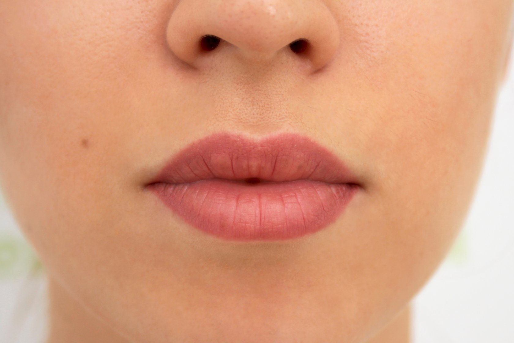 Сохнут губы — из-за чего это происходит у женщин и мужчин?