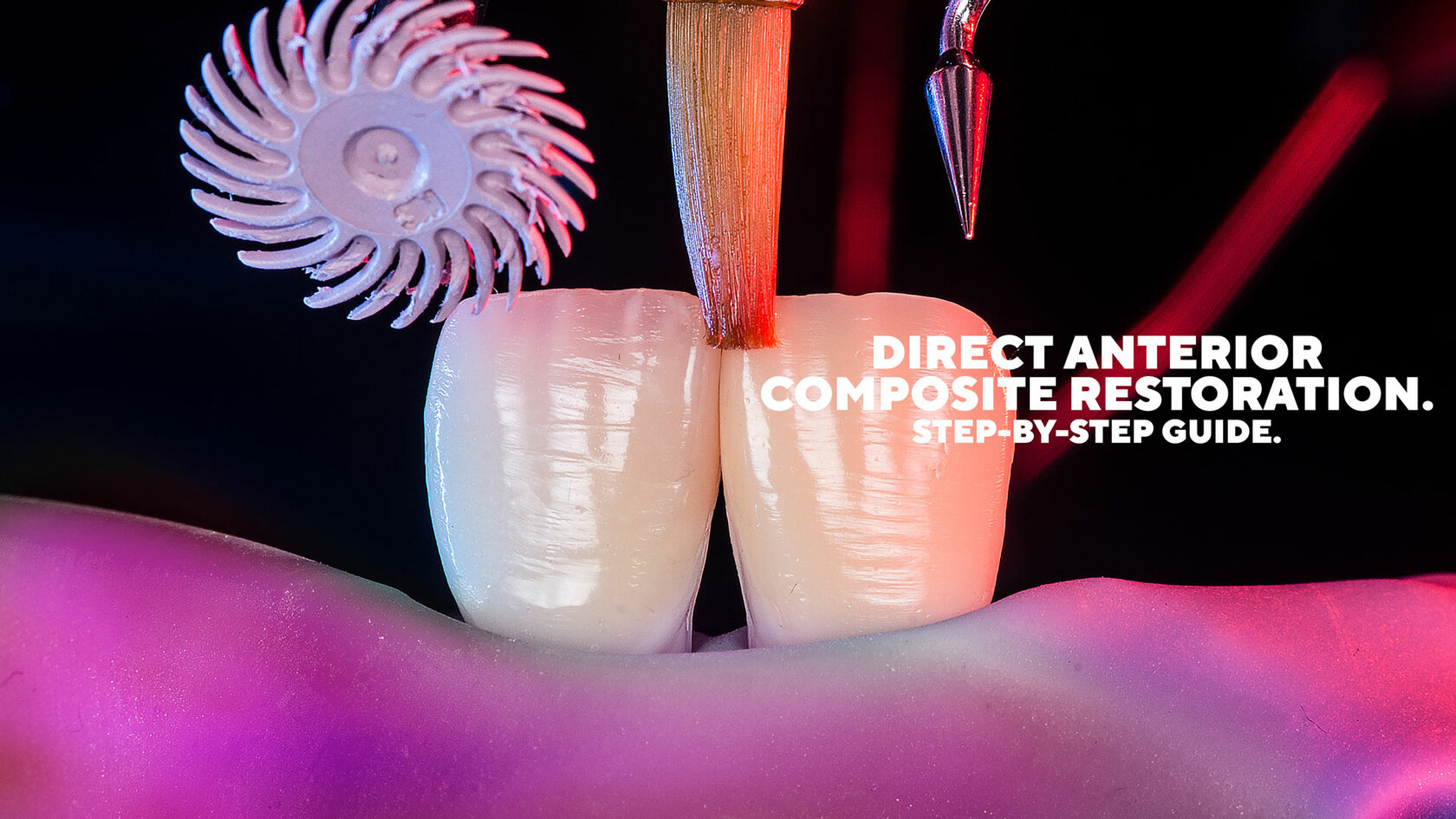 Direct Anterior Composite restoration. Stepbystep guide.
