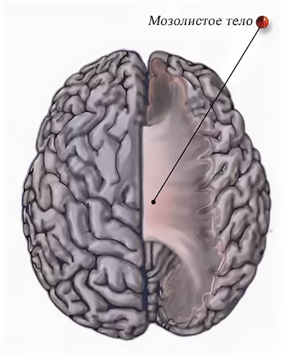 Мозолистое тело какая ткань. Мозолистое тело головного мозга. Мозолистое тело и большие полушария. Мозолистое тело больших полушарий. Часть мозолистого тела полушарий головного мозга.