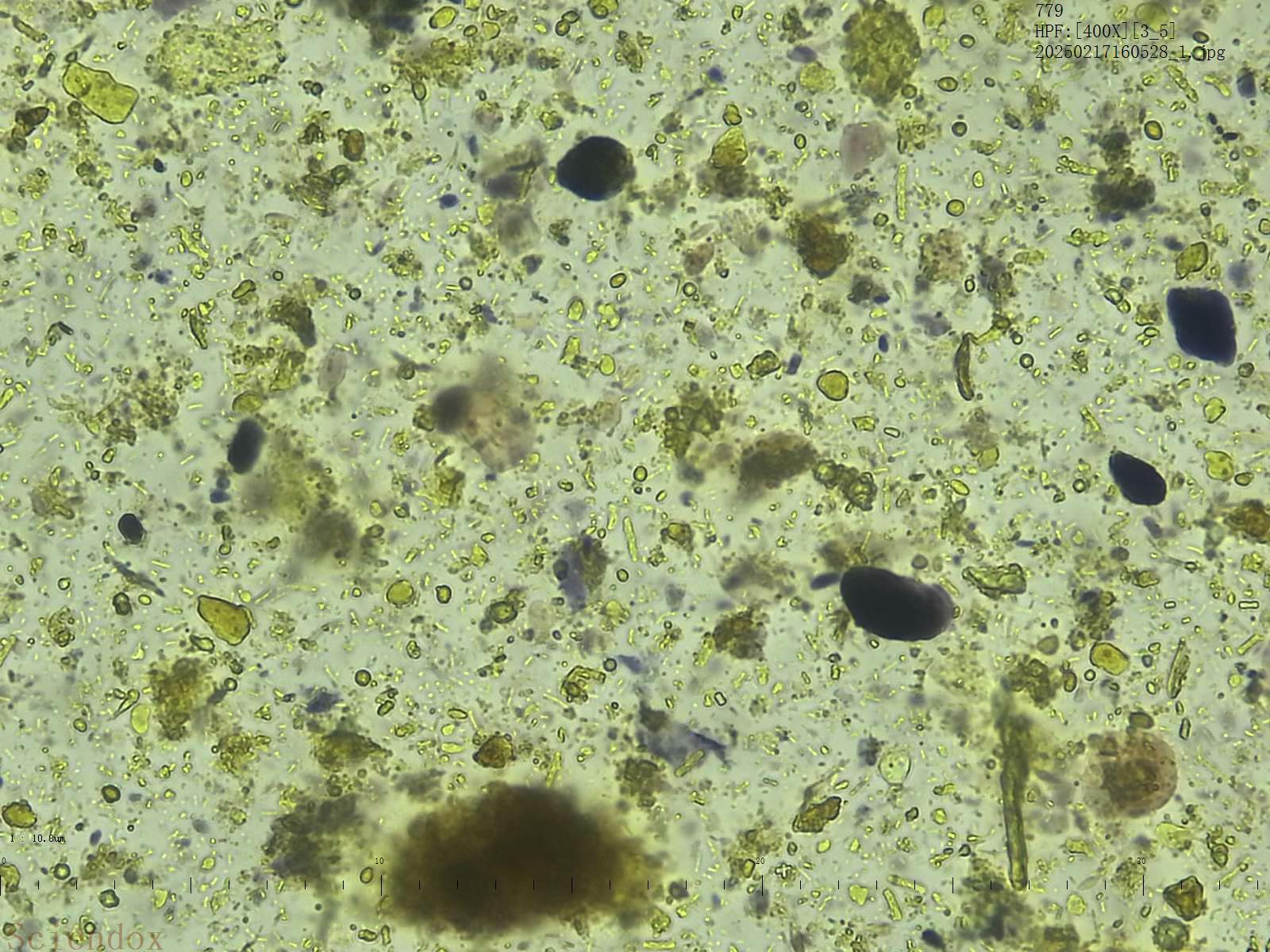 Окрашенный Люголем препарат кала, фото со станции Sciendox 2000R 