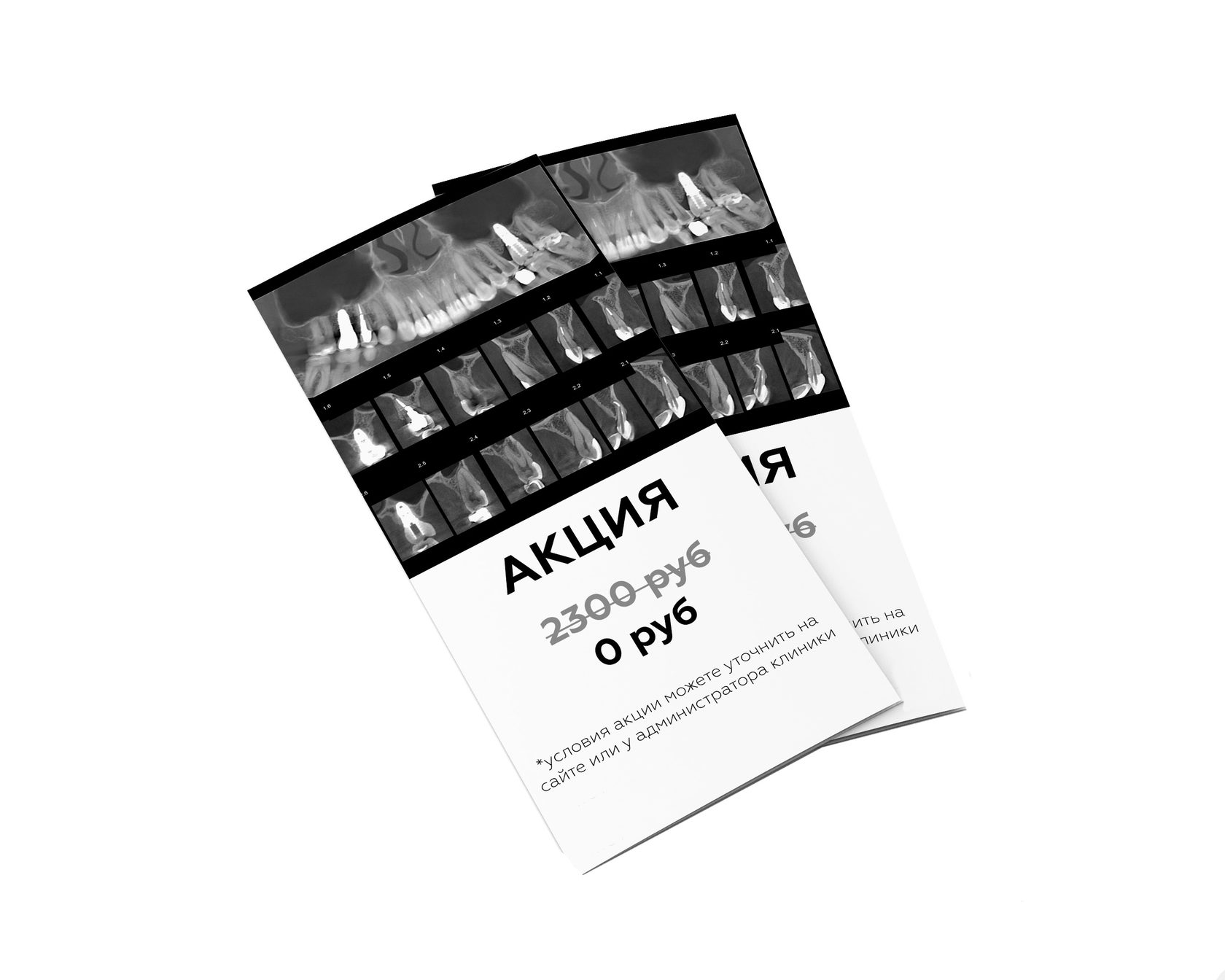 Установка виниров в стоматологии Demokrat в Дербенте. Акция бесплатный первичный прием