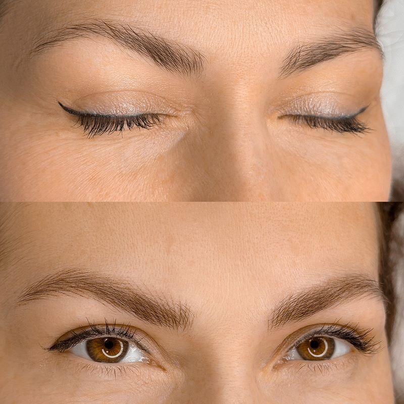микроблейдинг бровей до и после