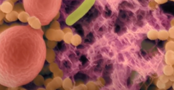 Почему появляется неприятный запах изо рта