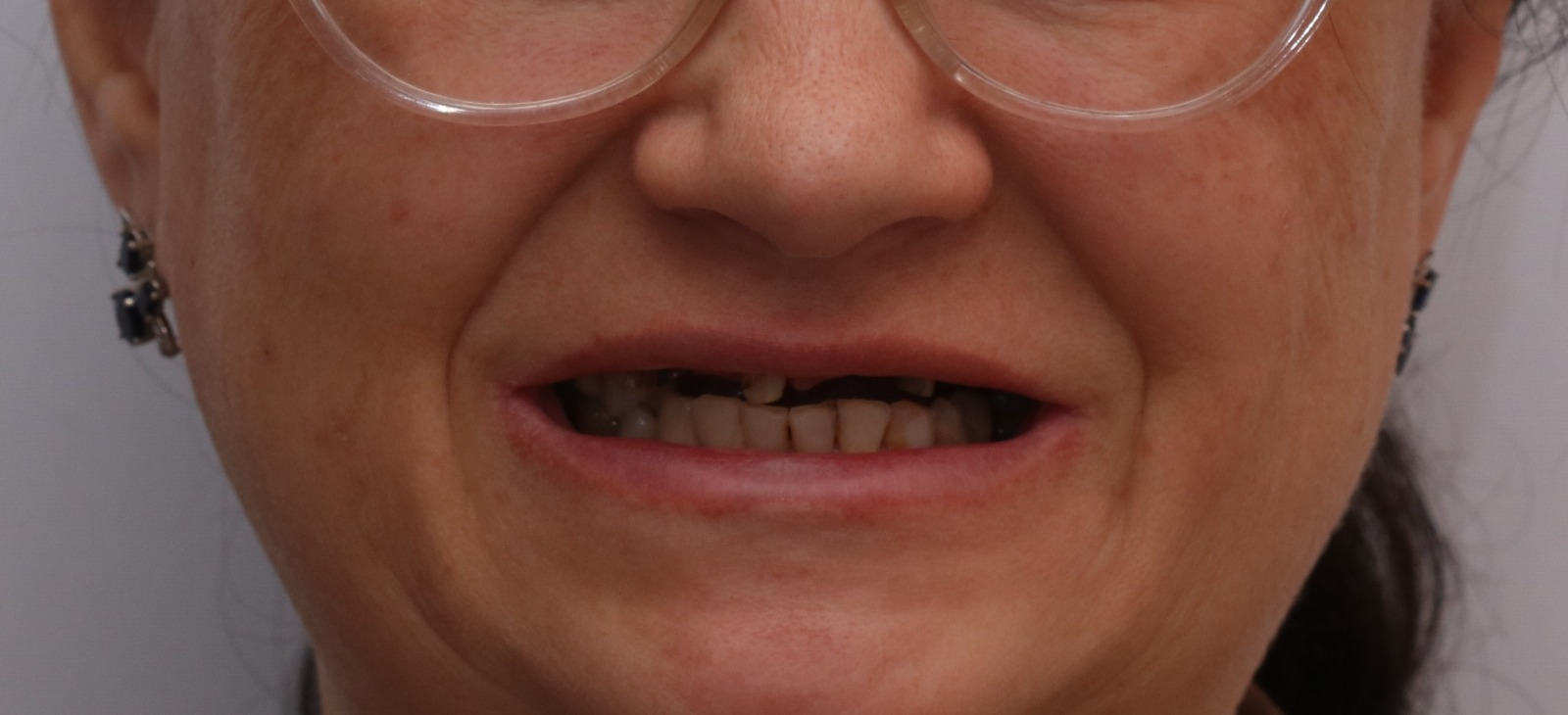 до