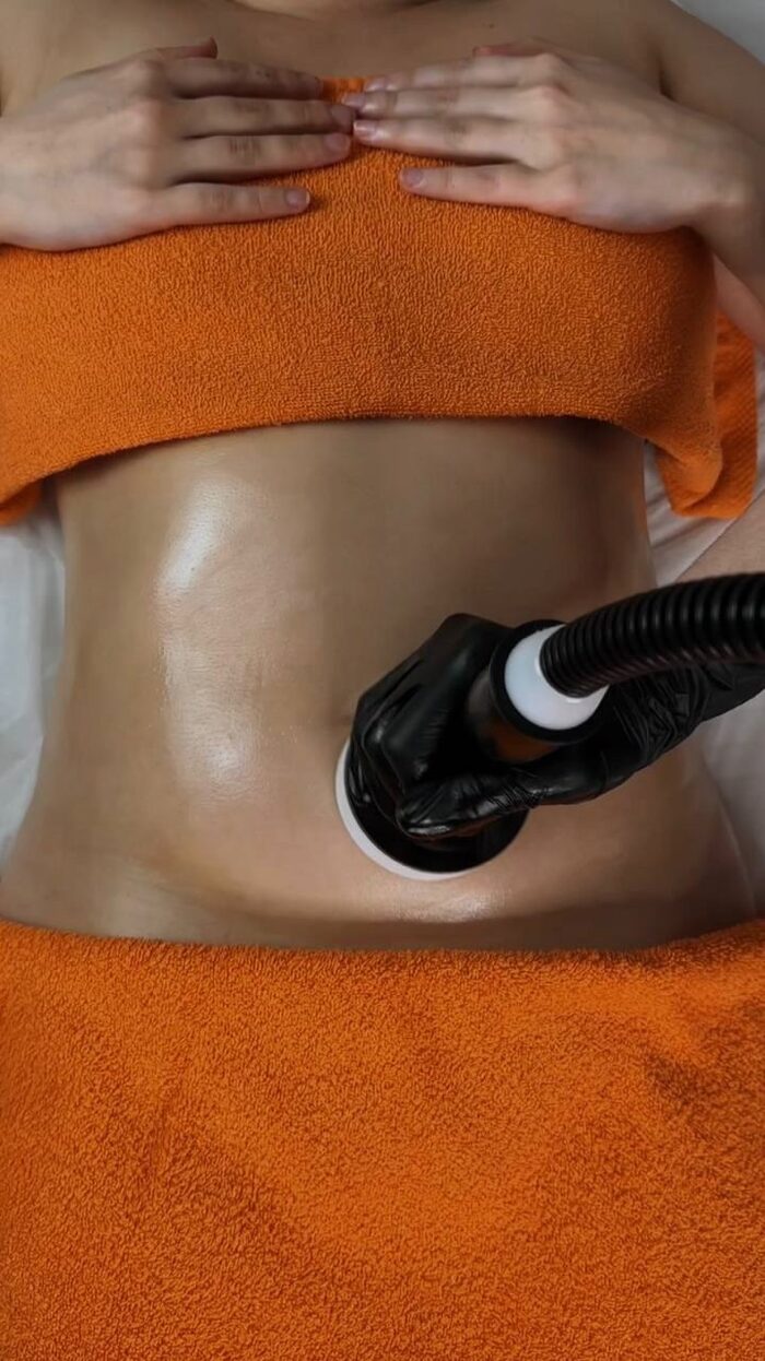 Микроволновой липолиз в студии А.М — неинвазивная коррекция контуров тела во Владимире