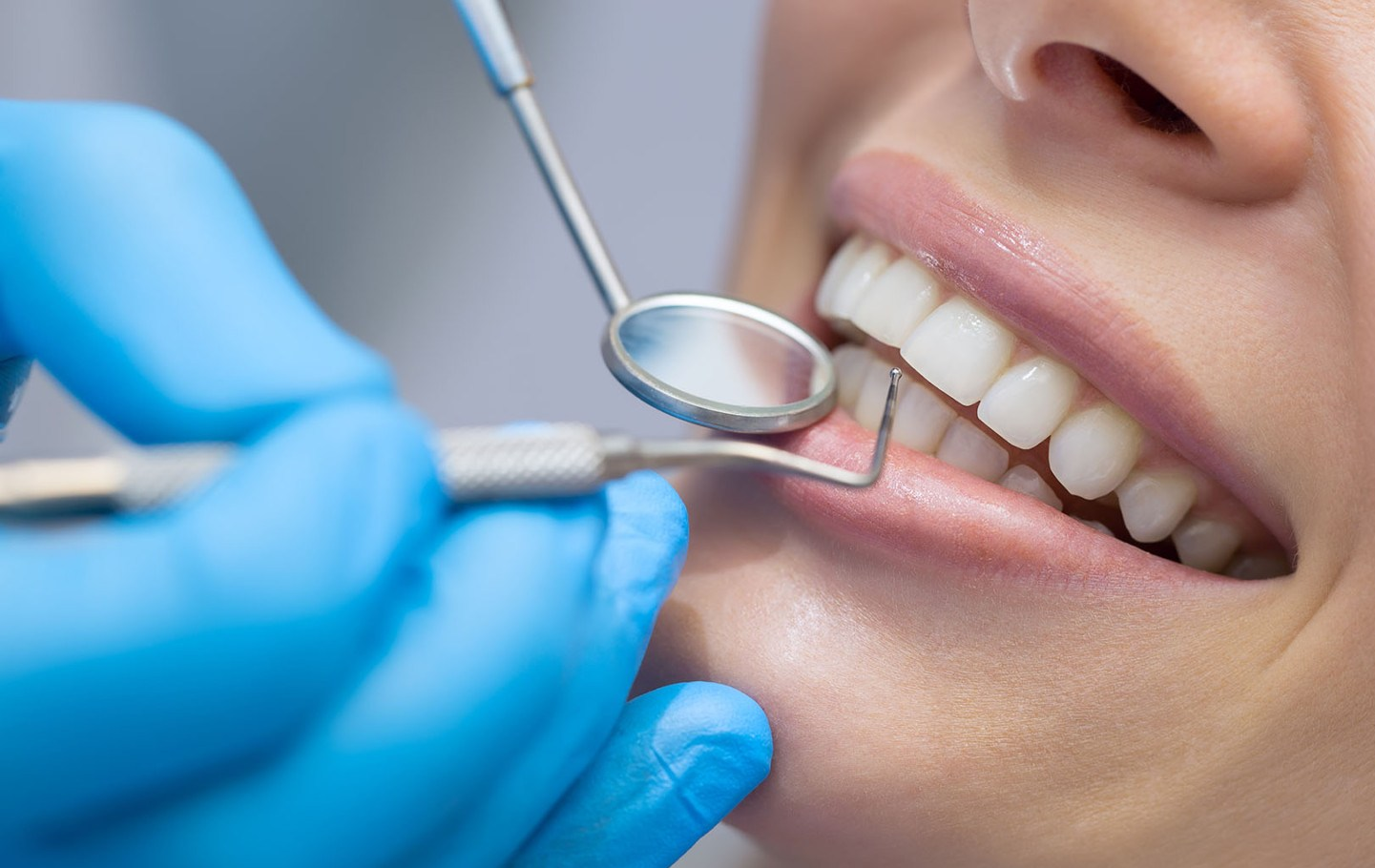 Как вылечить кариес без стоматолога