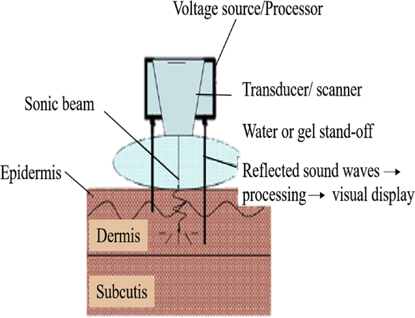 Рисунок 10 Изображение ультразвукового устройства, включая источник напряжения, преобразователь, водонепроницаемость или гель, и звуковой луч, проецируемый на кожу