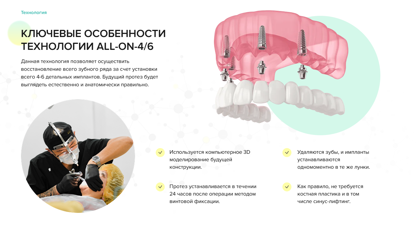 Обезличенный архивный блок лендинга All-on-4 с визуальным объяснением технологии