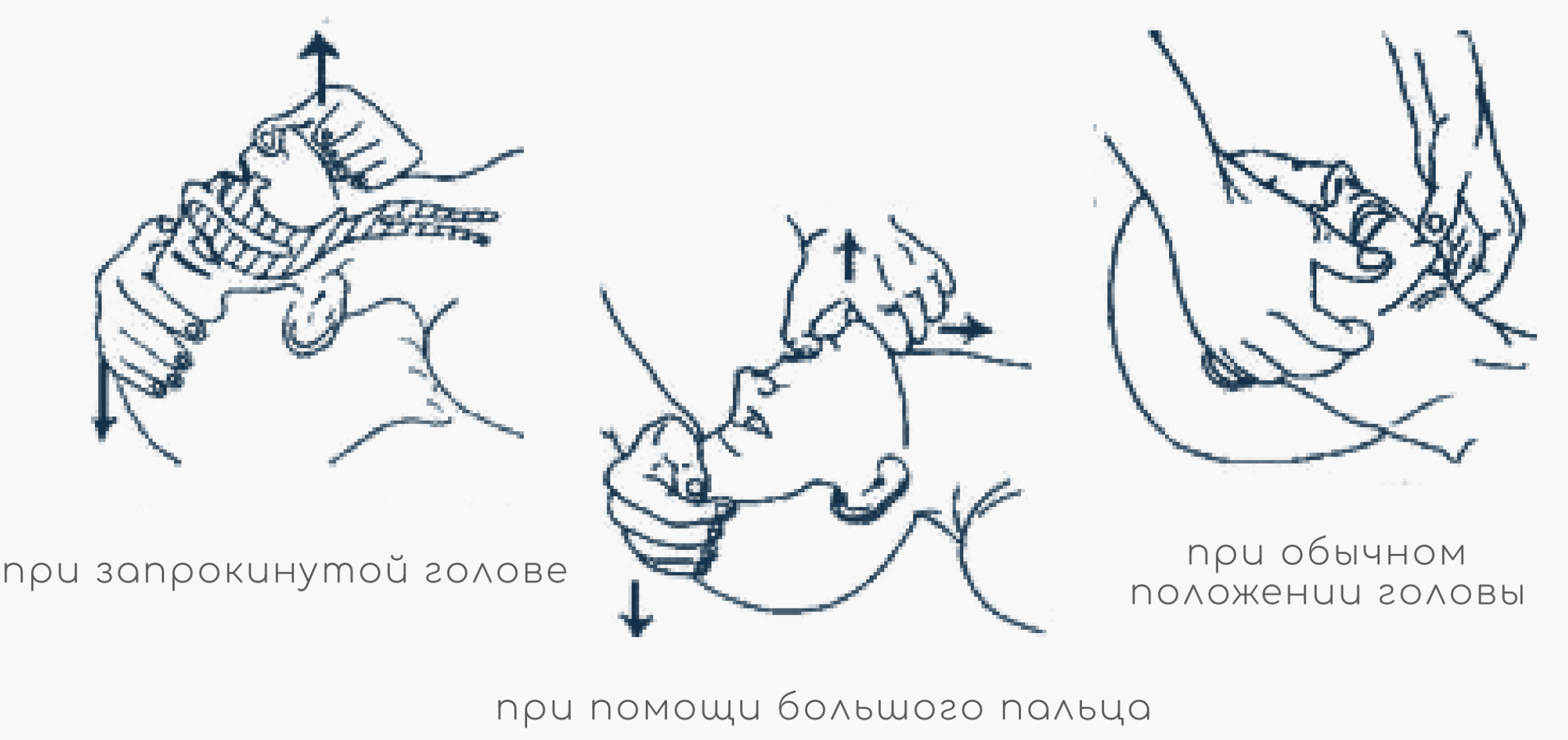 Глубина компрессий при СЛР. Глубина компрессий грудной клетки при СЛР. Глубина компрессий при сердечно-легочной реанимации. Глубина компрессий при сердечно-легочной. Сжатие груди