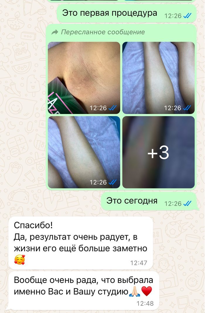 Отзыв клиентки LA ZERO в WhatsApp