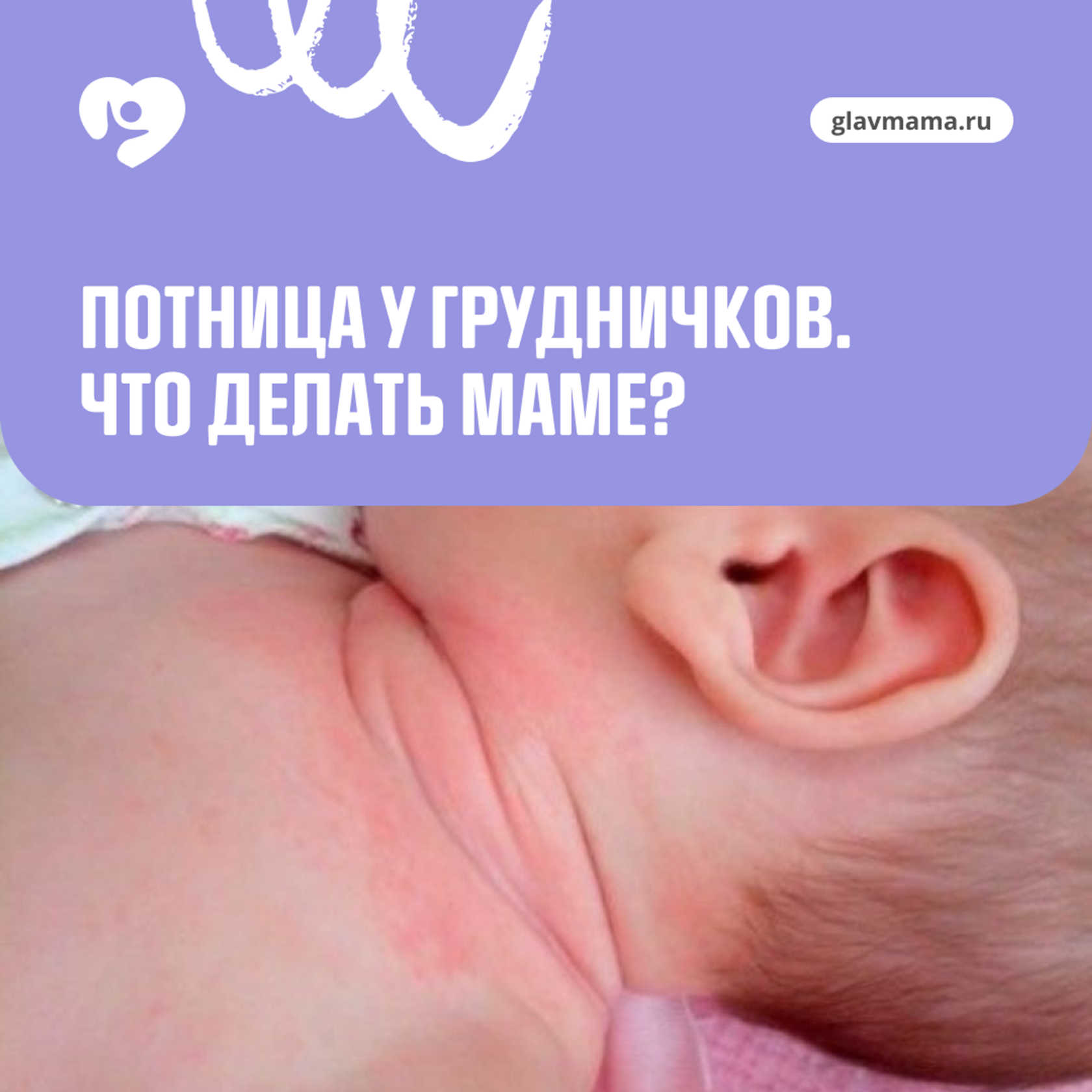 Потница у новорожденных: как выглядит и чем лечить? | Nestlé Baby&Me