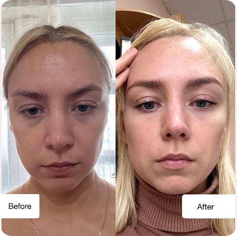 Before and after