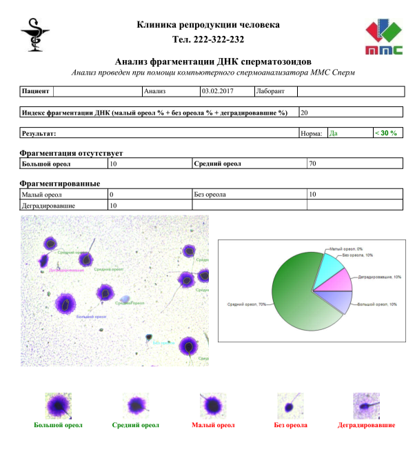 Спермограмма | Анализ спермы | iVF Riga